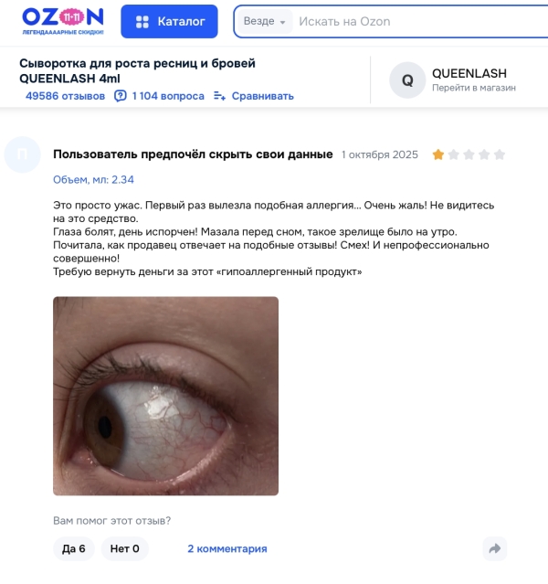 Queenlash отзывы: стоит ли доверять популярной сыворотке для роста ресниц?
